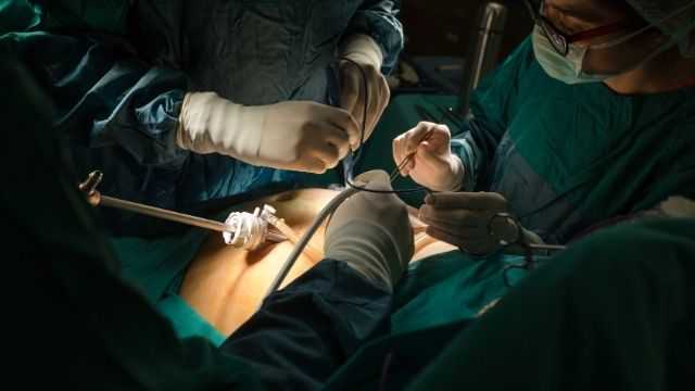 Laparoscopic Myomectomy (2) Laparoscopic Myomectomy (2)